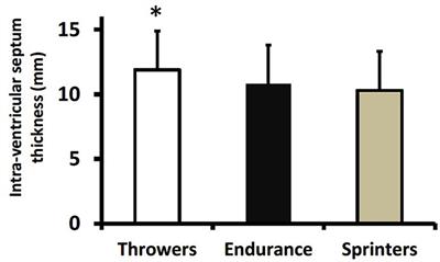 Left Ventricular Dimensions and Diastolic Function Are Different in Throwers, Endurance Athletes, and Sprinters From the World Masters Athletics Championships